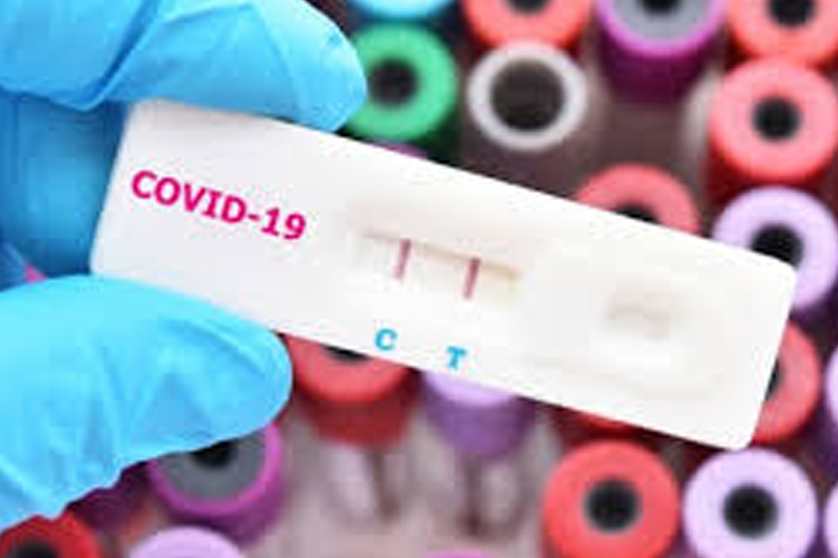 Apakah Anda Perlu Rapid Test..???