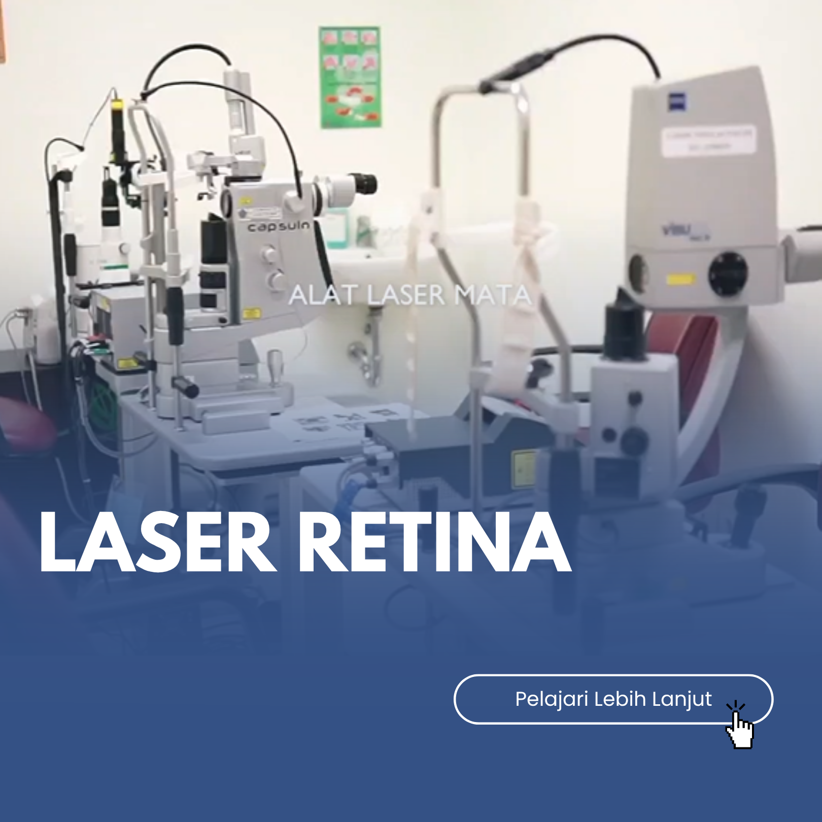 LASER RETINA
